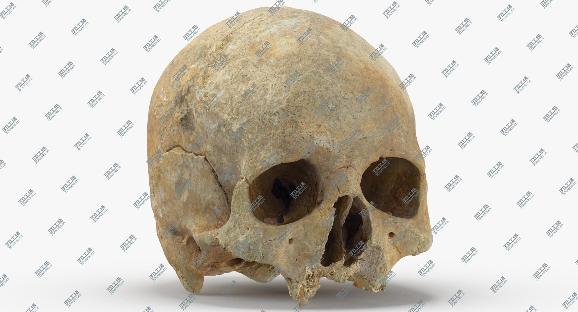 images/goods_img/202104023/Real Human Skull Cranium with Leprosy 01 3D model/1.jpg